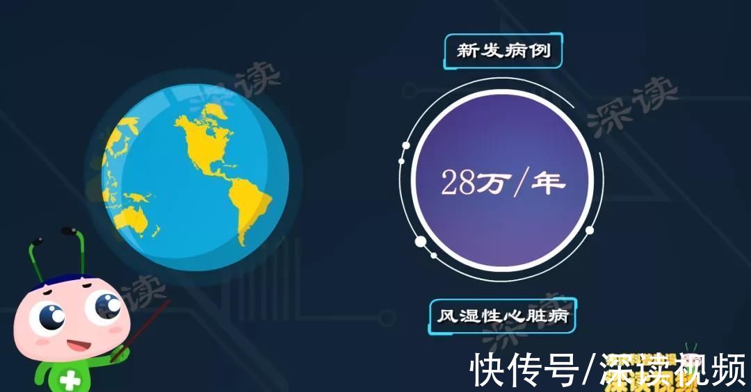 脸红心跳？呼吸费劲？腿软无力？万恶的风心病，每年祸害28万人