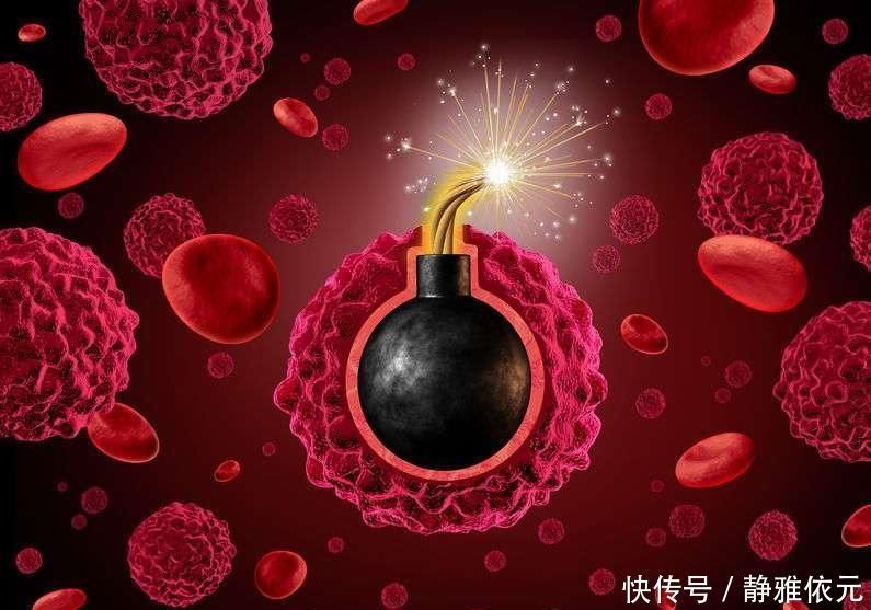 身体|癌症三年内没有复发,可高枕无忧?如何判断身体是否恢复