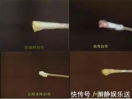 谷谷丁|28岁女子,经血不断,查出宫颈癌,与“高危丈夫”,脱不了干系