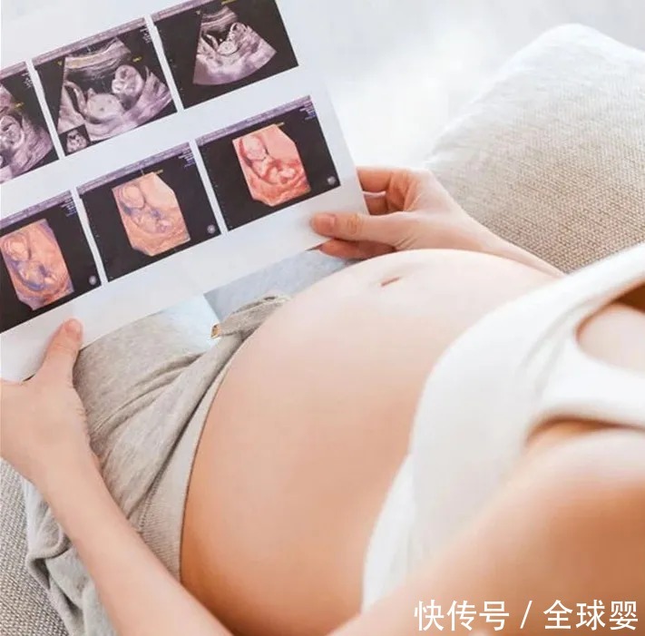 长睫毛|宝宝以后的颜值,看这个就知道