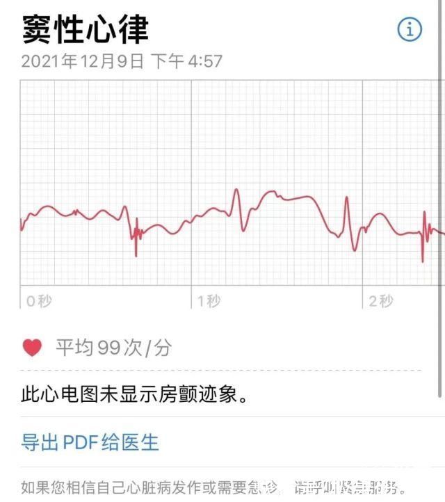 w苹果手表「心电图」功能解锁，支持4款机型，快来看你的能不能用