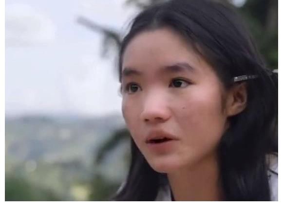 《變形計(jì)》李勒優(yōu)：臉上痘痘減少，回憶變形細(xì)節(jié)強(qiáng)忍難過(guò)