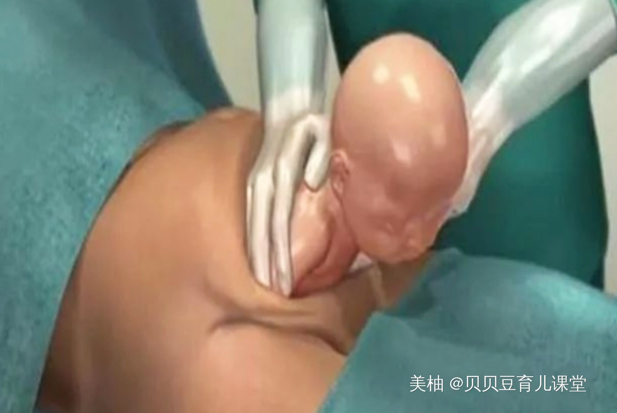 流程图|看过这几张剖腹产模拟流程图，产妇更害怕了，网友确实很形象