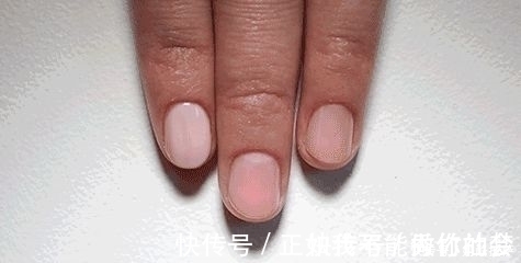 指尖|关于指甲的一些冷知识,指甲剪太短危害有多大?