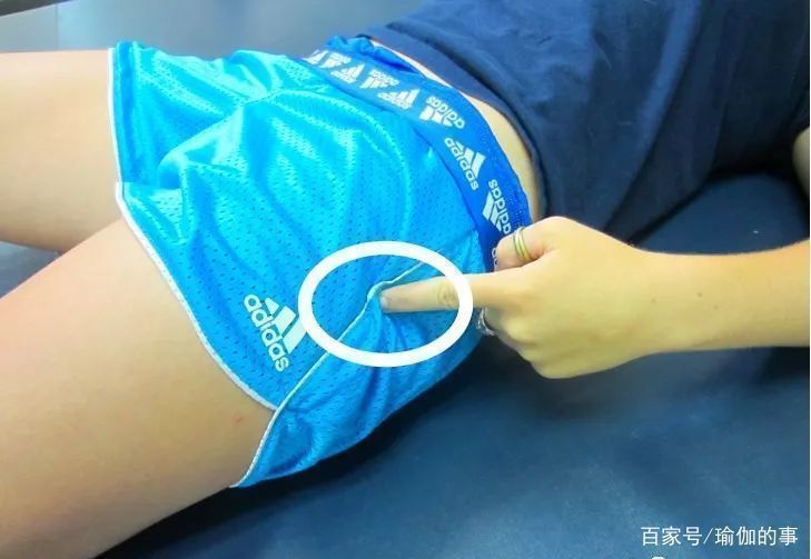 髂胫束|练瑜伽，髋部打不开，膝外侧疼常被忽视的髂胫束很重要