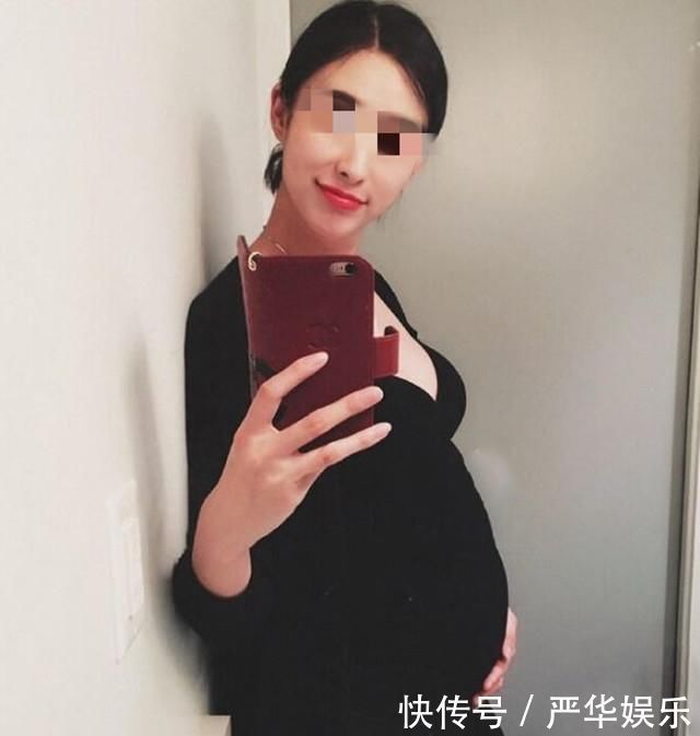 宝妈|产妇在剖腹产时提出“吸脂”要求,医生听后乐了肚子肉不归我管