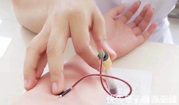 度数|再次提醒：近视超过600度的人，3件事情尽量别做，容易加深度数