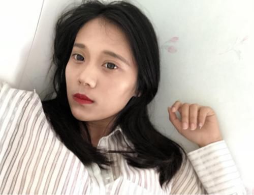 女子|28岁女子因常吃一“零嘴”,皮肤慢慢变白,皮肤科医生:值得借鉴