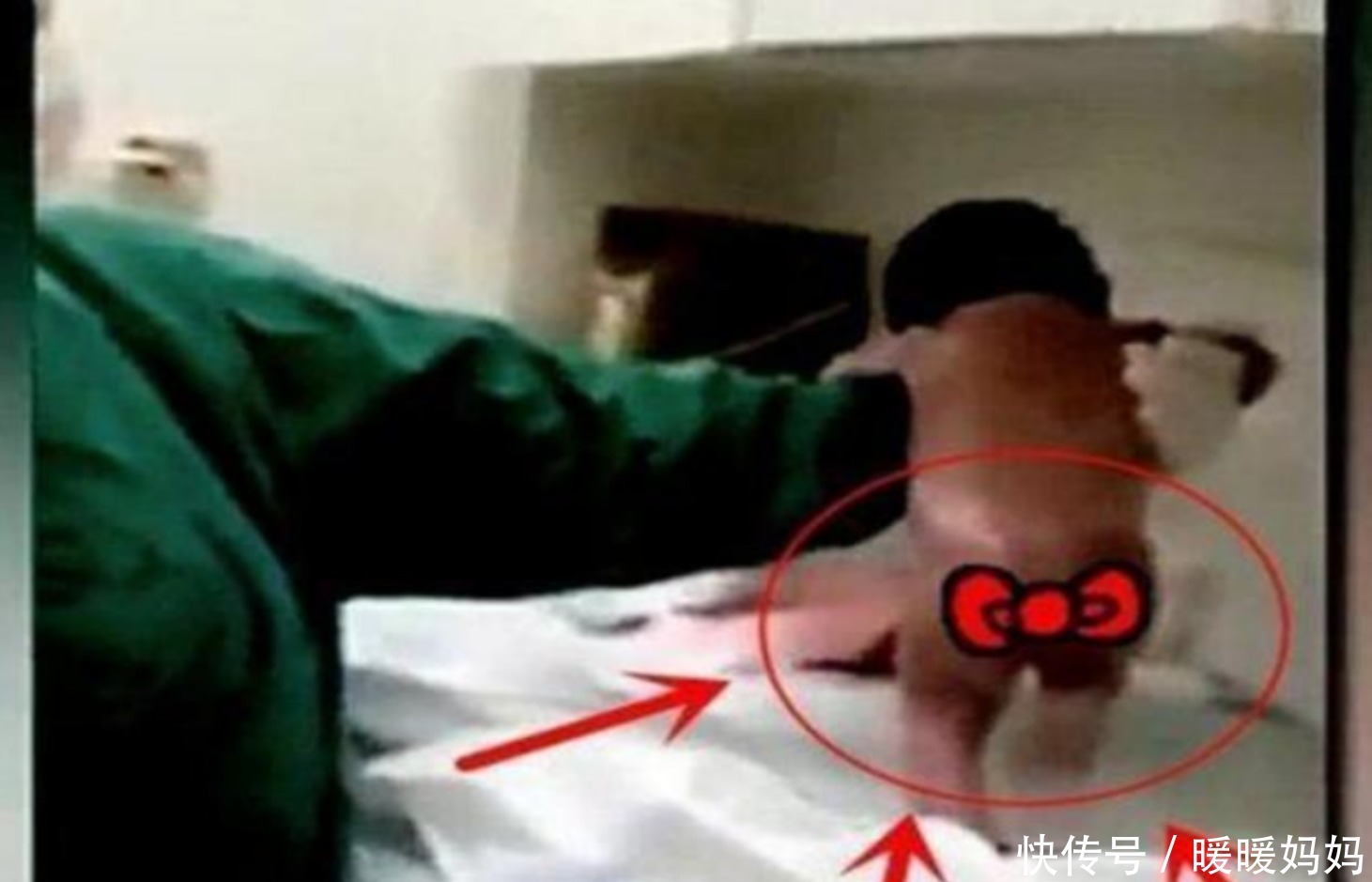 脐带|“最着急新生儿”火了!刚剪完脐带就要“跑”,医生都差点没抓住