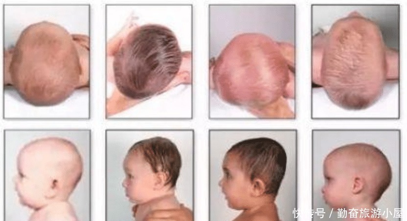 婴儿|婴儿怎样的睡姿头型好看 宝妈盲目的调整,宝宝颜值和健康可能都受影响