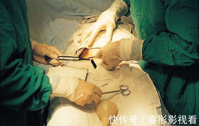 区别|剖腹产的半麻和全麻,到底有什么区别?后者关系到胎儿健康