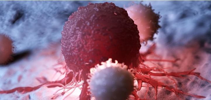 癌细胞|癌症晚期有多疼?甚至能够超过骨折!直接侵犯神经痛到生不如死