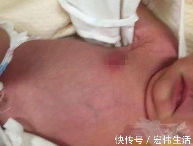 乳头|宝宝哭闹不止,妈妈掀开衣服后瞬间爆炸:原来是奶奶做了“手脚”