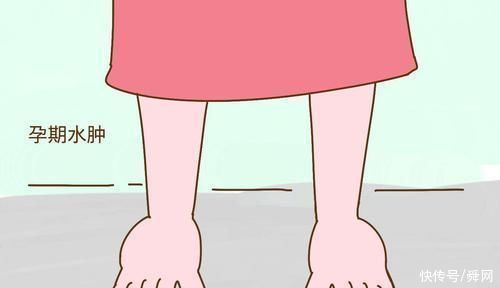 子宫|孕期水肿，如何判断哪些是正常或不正常呢?