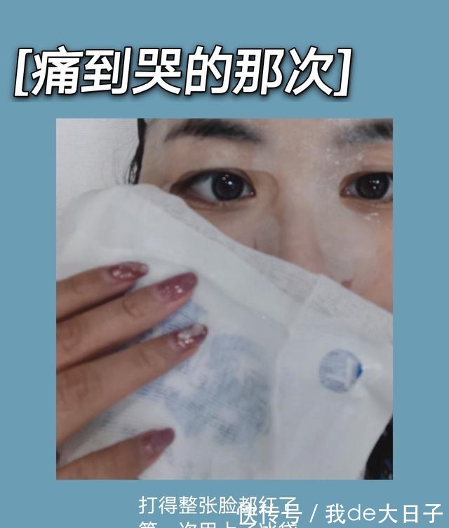 光子嫩肤 6次光子嫩肤后,我的脸怎么样了!