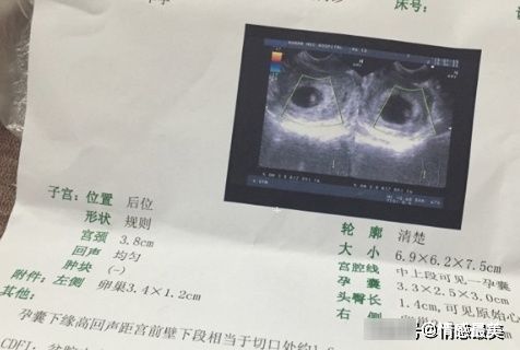 彩超单上的数据，或许跟胎儿性别有关，看完你就知道了，值得一看