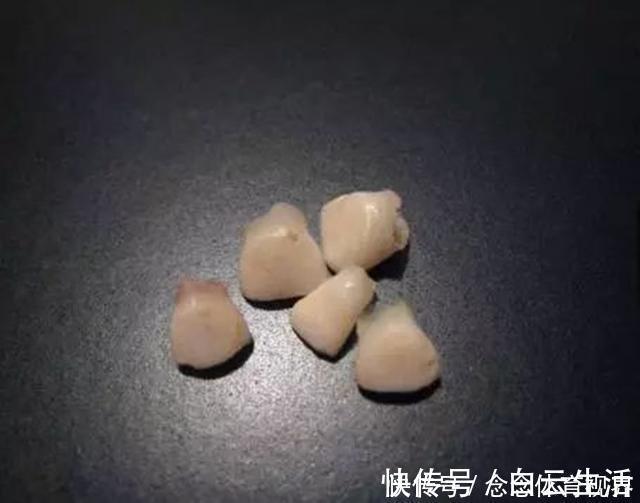 干细胞|孩子乳牙储存起来，能救命？是有条件的，家长别交智商税