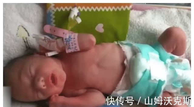 杨凌云|癌症孕妇瘦成皮包骨,还一心为丈夫留后,丈夫却称大人孩子都不要