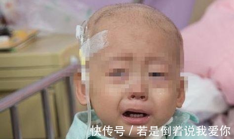 医生|白血病开始走向“低龄化”,医生警告这1样东西还是少往家里买!