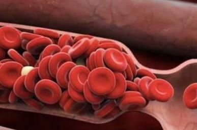 血管堵不堵,看脚就知,若你脚上没有3个现象,恭喜,血管还年轻