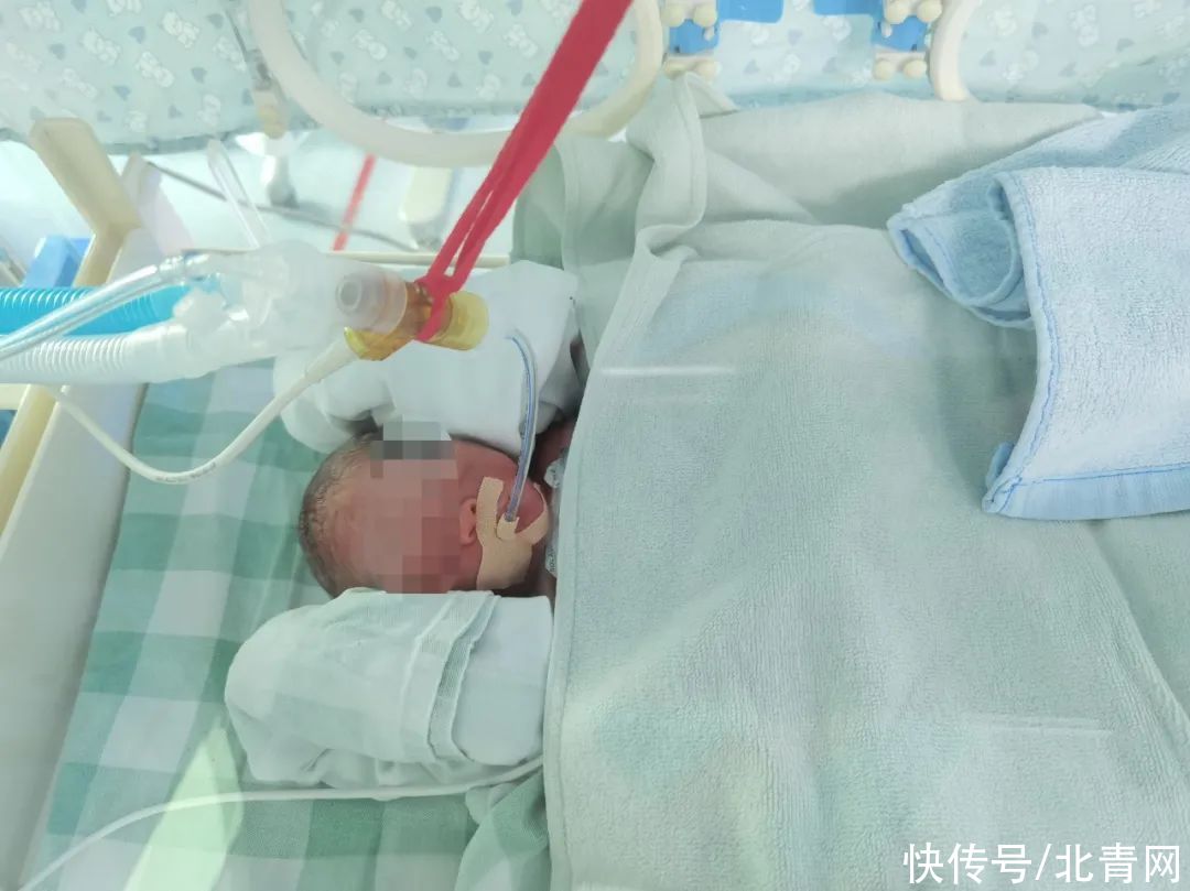 早产|在封闭区产房，三分钟抢回早产儿生命