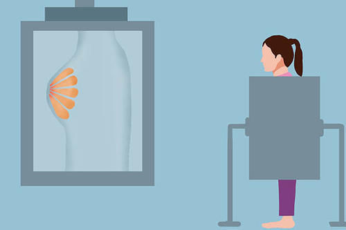 息肉|体检查出的结节、增生和息肉，哪些会癌变，哪些不要治？