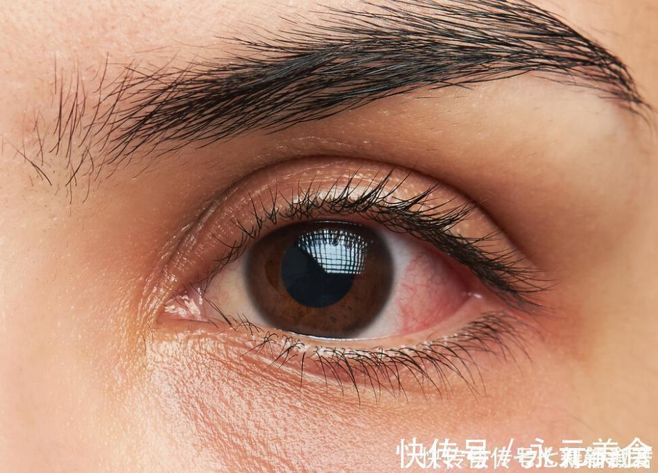 胆汁|肝脏的“黄金搭档”找到了,不是菊花,平时可劲喝,肝脏越发健康