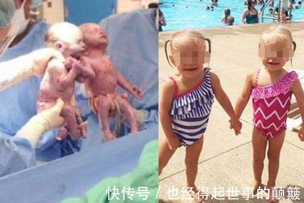 形影不离|双胞胎姐妹花手牵手一起出生,如今2岁了,两个人依旧是形影不离