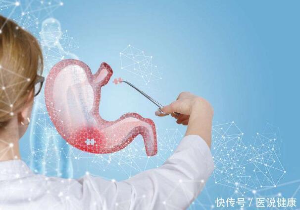 胃病|饭后胃部出现4种不适时,要及时检查,以免“拖”成胃病,别忽视