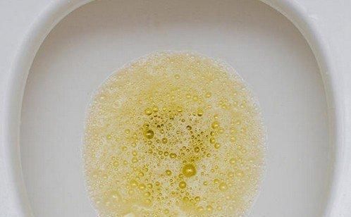 肝受损后，早上醒来可能有5个表现，一个都没有，那身体还健康