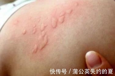 宝宝|奇闻:宝宝全身起小疙瘩,妈妈翻起床垫,看到画面,女子欲吐