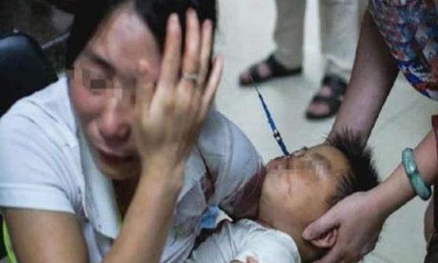 宝宝双眼近乎失明，都是因为家长的忽视，父母必看