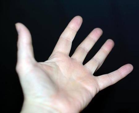 症状|手脚如果出现这些症状,你可能有高血糖了,再往下就是糖尿病