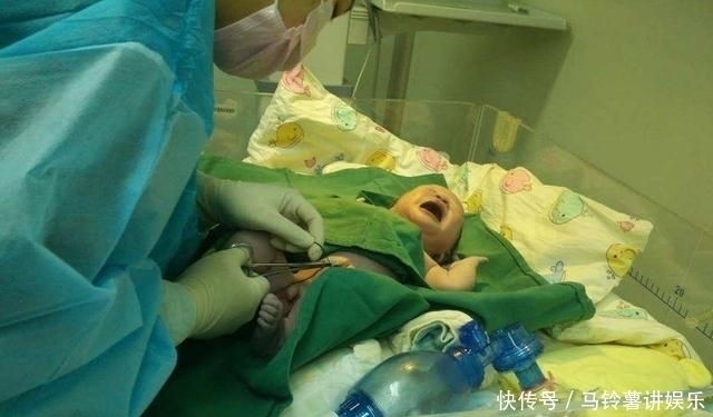 孩子自己“出生”,减轻产妇痛苦是好事医生更遭罪