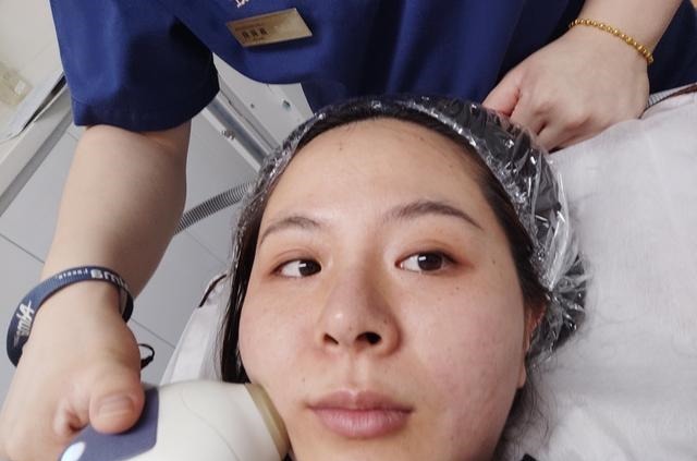 效果 医美抗衰初体验!效果真的很神奇!医美抗衰初体验!效果真的很神奇!