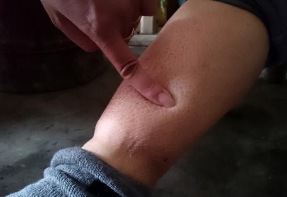 下肢浮肿|男性开始衰老，下肢会出现这些情况，如果没有说明还年轻