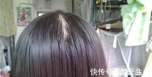 白头|土豆皮、生姜煮水洗头发，白头立即变黑？告诉你最靠谱的染发方法