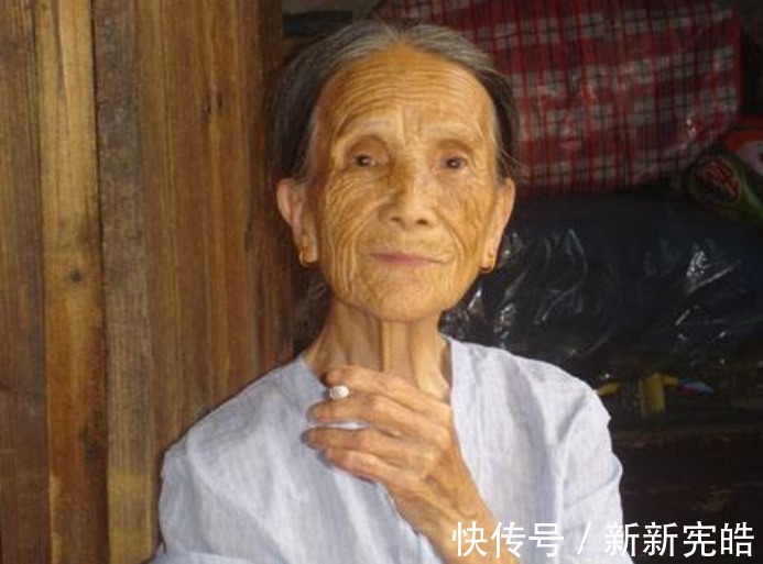 老人|70岁婆婆摔倒后骨折,营养师建议常吃2白喝1饮,骨龄年轻20岁