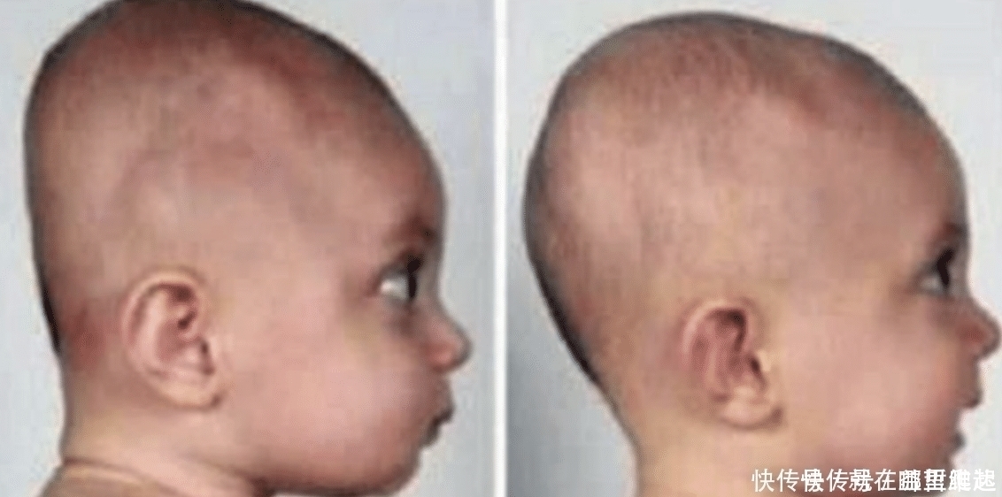 头型|睡枕头的孩子和不睡枕头的孩子,有哪些不同?区别还不小