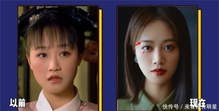 眼是美之窗,鼻是颜之魂;范芳医生谈国人常见鼻型及美学特点一