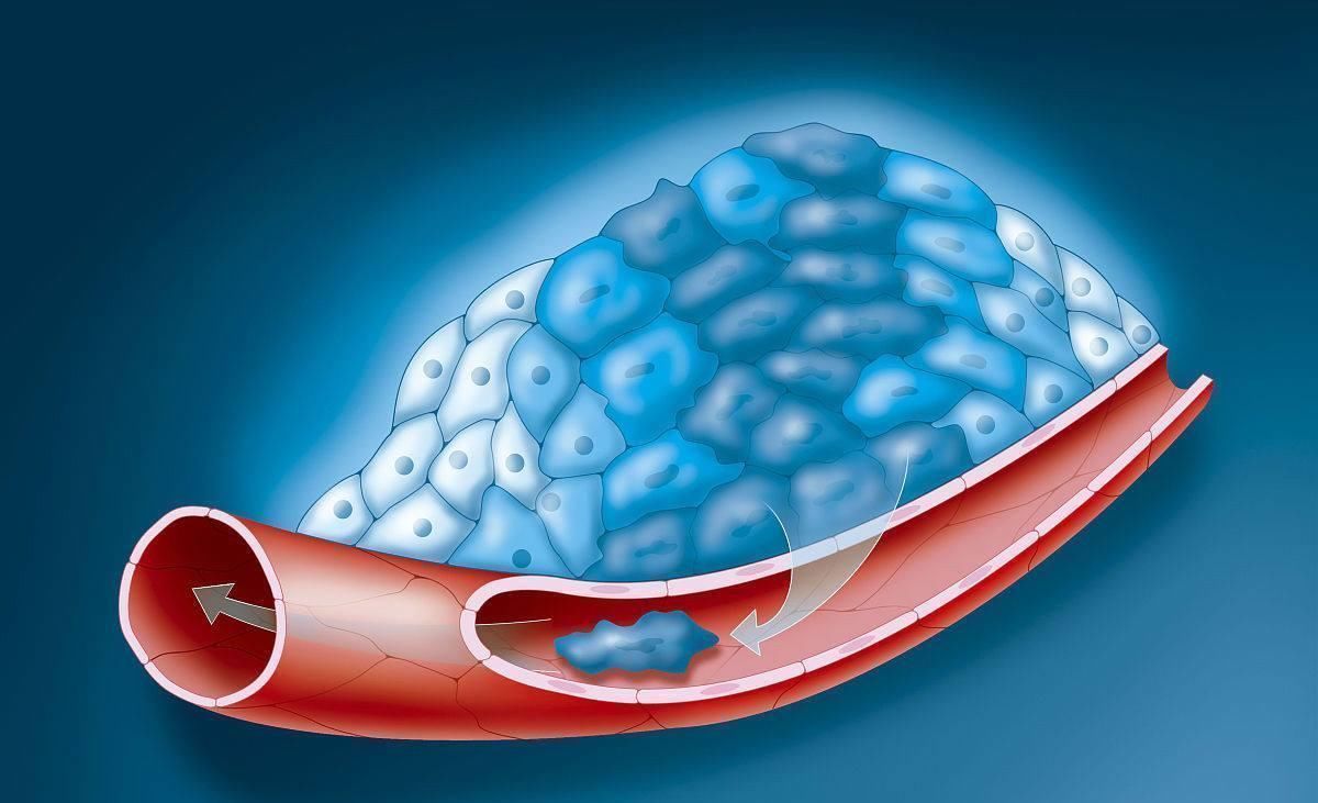 服药|血压多高，才要用降压药医生提醒这4种情况不一定需要吃药