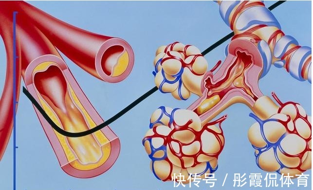 高脂血症|98岁中医，血管再堵，用对这个方法，快速解决高血脂，用1个好1个