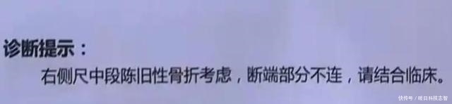 陈赫火锅店天花板砸伤顾客,店家只愿赔4万,伤者无奈公开维权!