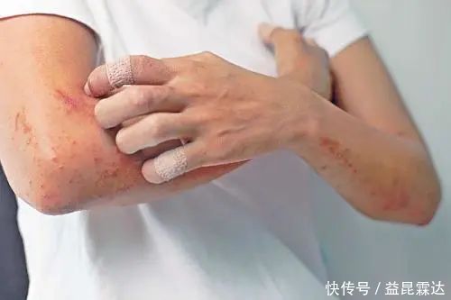 女孩|24岁女孩查出糖尿病,提醒:这玩意一杯顶五罐可乐,还敢天天喝