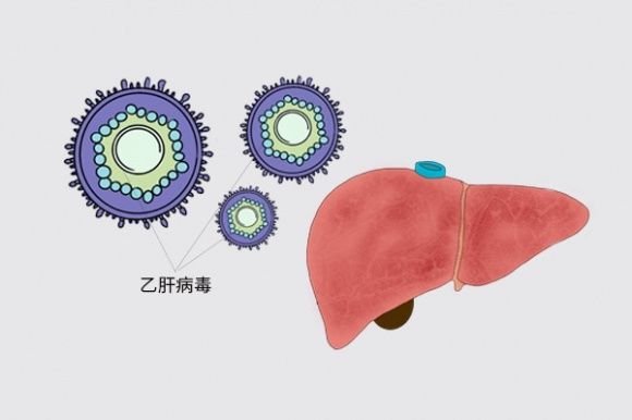 检测乙肝病毒DNA，数值降至多少，才能够停药？列出4点要求