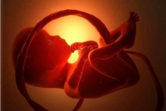 怀孕期间遭遇“脐带断裂”，胎儿也面临引产，医生：并非悄无声息