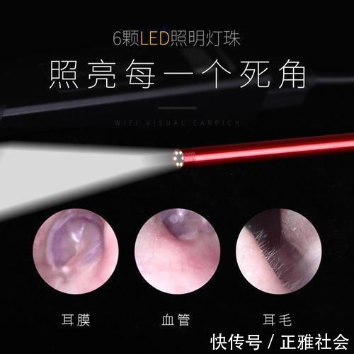 小冰|生下来从不掏耳朵的孩子:6年的耳屎变成“水泥柱子”,多久清理一次合适?