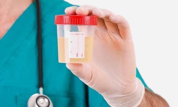 血压计|只是血压很高，但医生要求我做四项检查，以前不明白，现在知道了