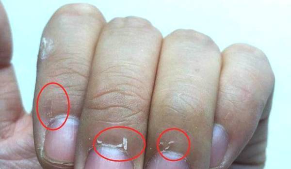妇科疾病|没有妇科疾病的女人,手上有4个特征,你若占1个,子宫很健康