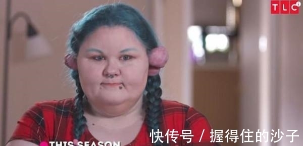 蟹足肿|爱漂亮穿耳洞　她耳骨长出4颗400g肿瘤伴随11年